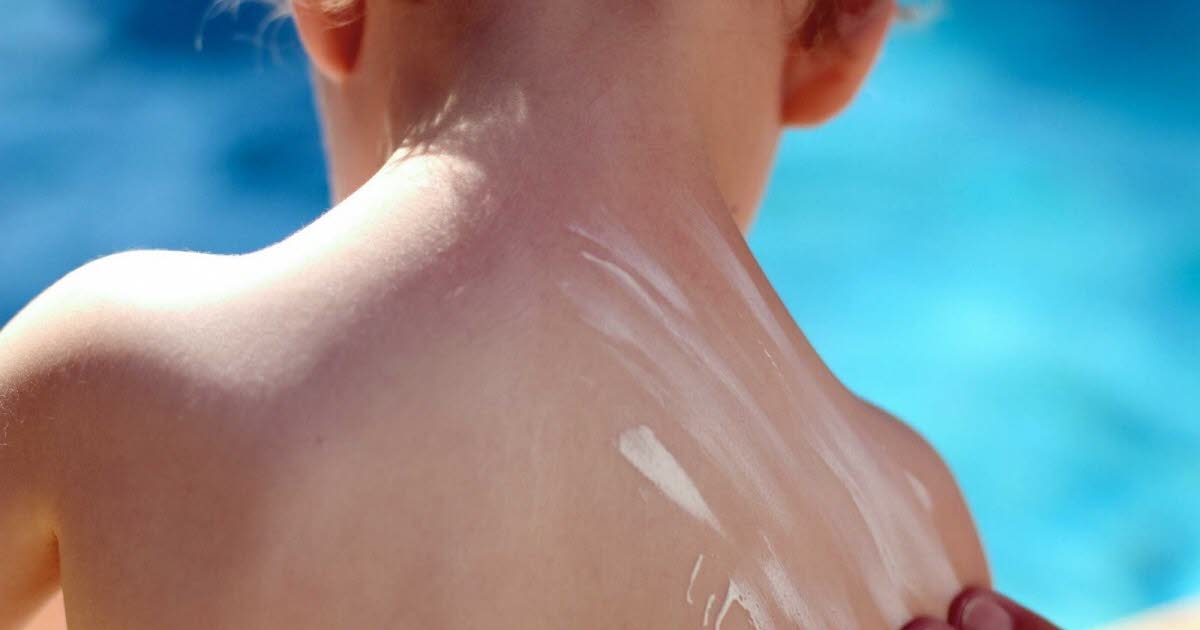 Health. “Protection is all year round”: Children remain poorly protected from the sun