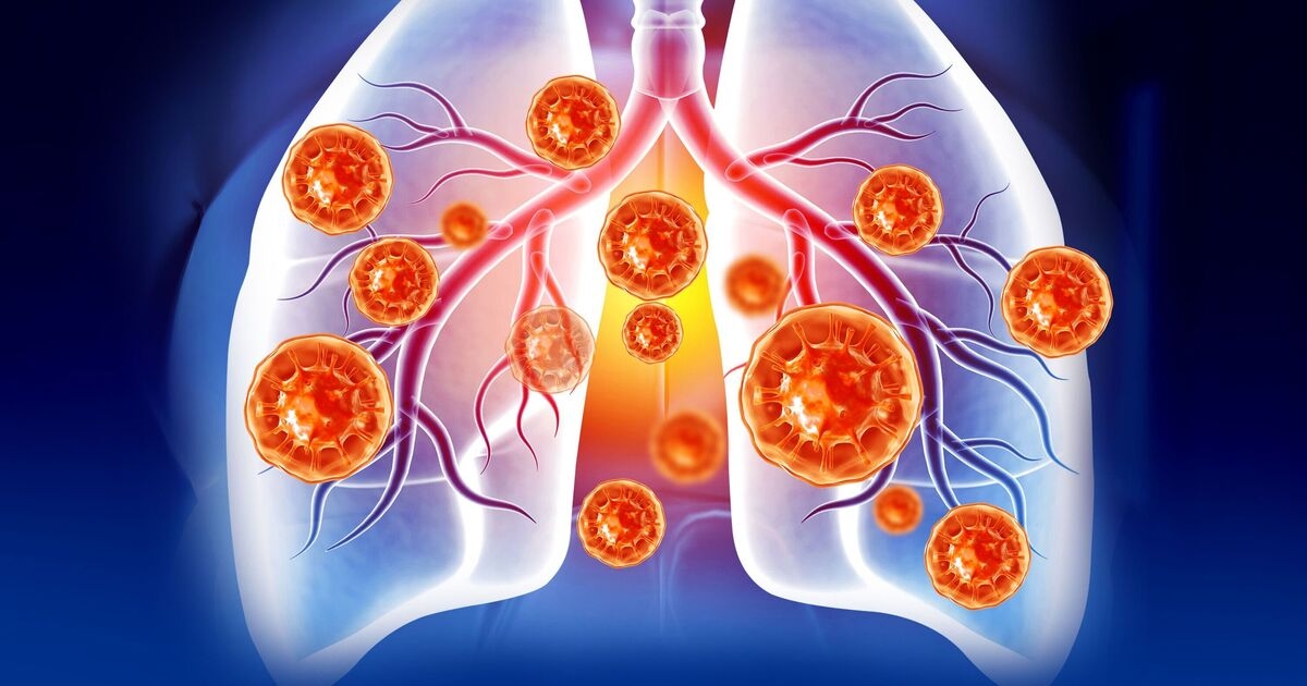 The one common habit that primes the lungs for deadly Covid damage