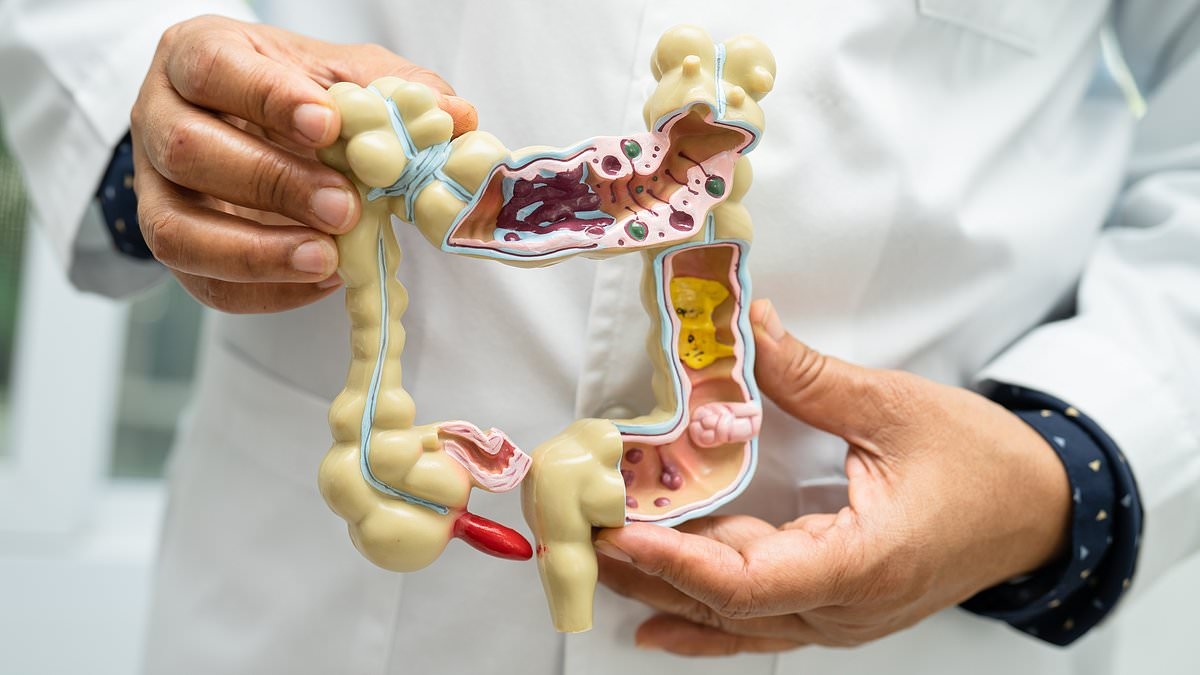 REVELADO: Lo único que puede hacer por su hijo para reducir sus probabilidades de padecer cáncer de intestino en el futuro