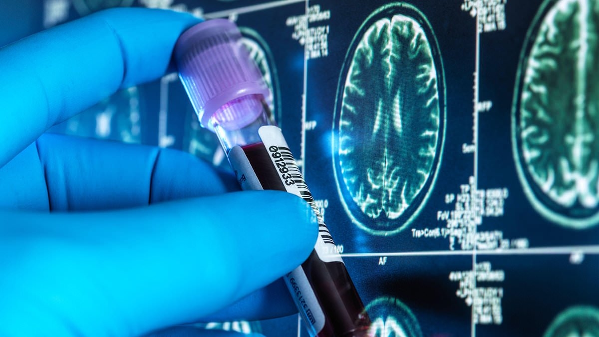 Miles de británicos recibirán análisis de sangre baratos para el Alzheimer en un ensayo histórico