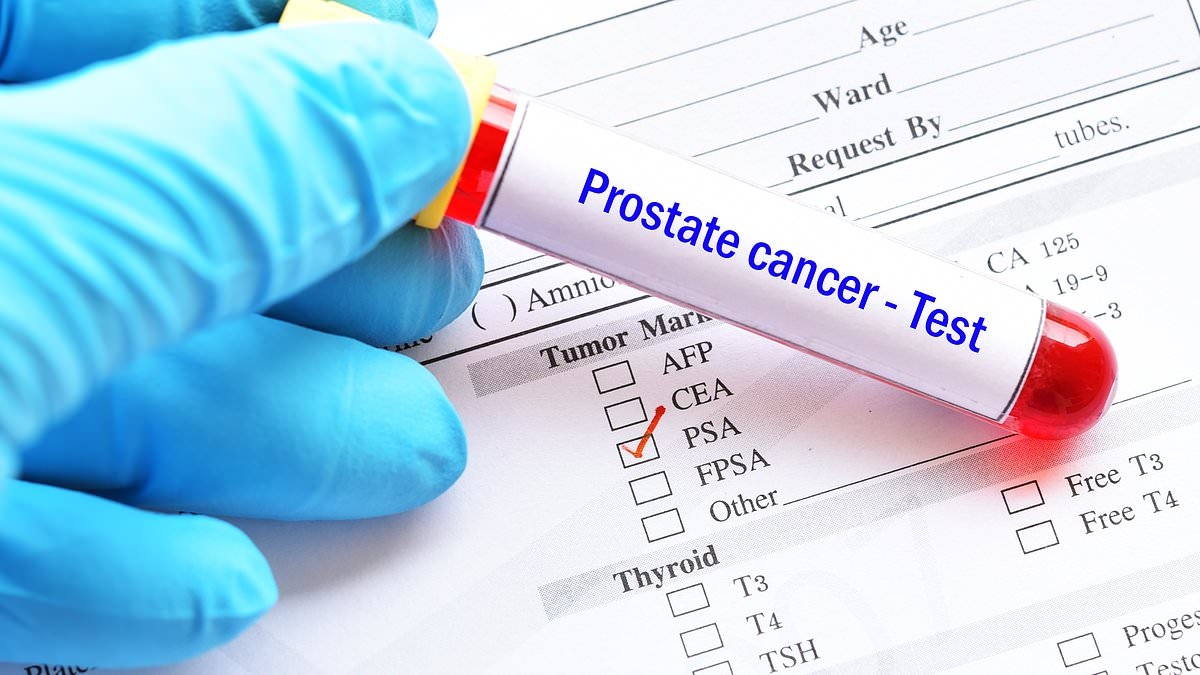 Prostate cancer screening slashes risk of dying from the disease by 13 per cent, major study reveals
