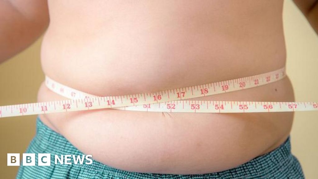 More children are obese than underweight, says Unicef