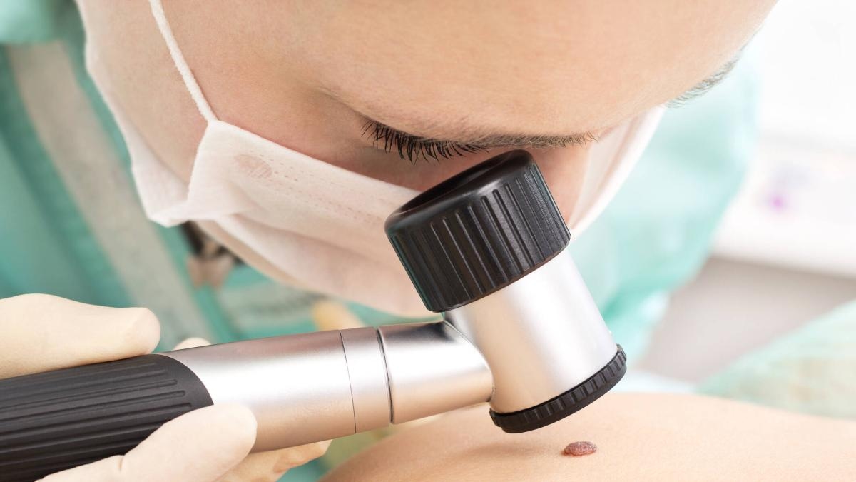 Diagnoses van huidkanker in Bogotá met 37% toegenomen: 'Sommige mensen hebben het zonder het te weten'