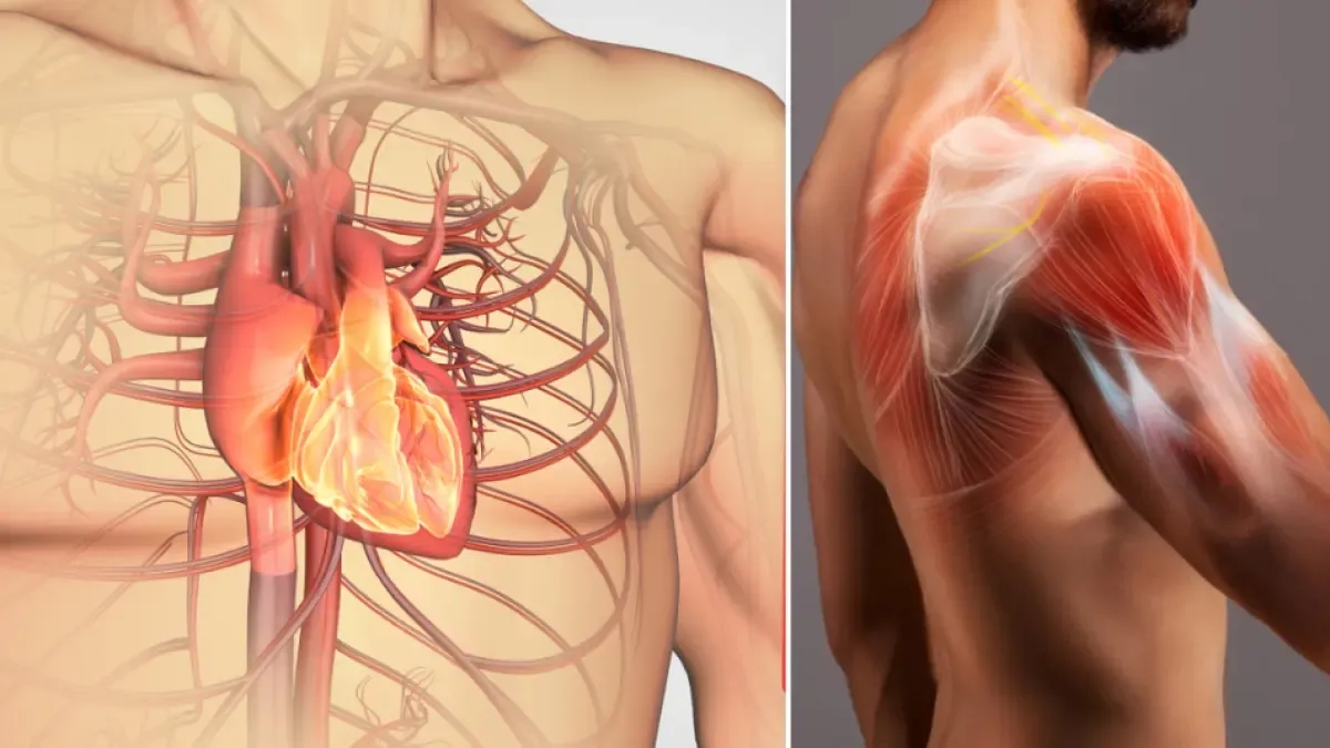 Secondo un nuovo studio, il grasso che si accumula tra i muscoli potrebbe essere un nuovo nemico silenzioso per la salute cardiovascolare.