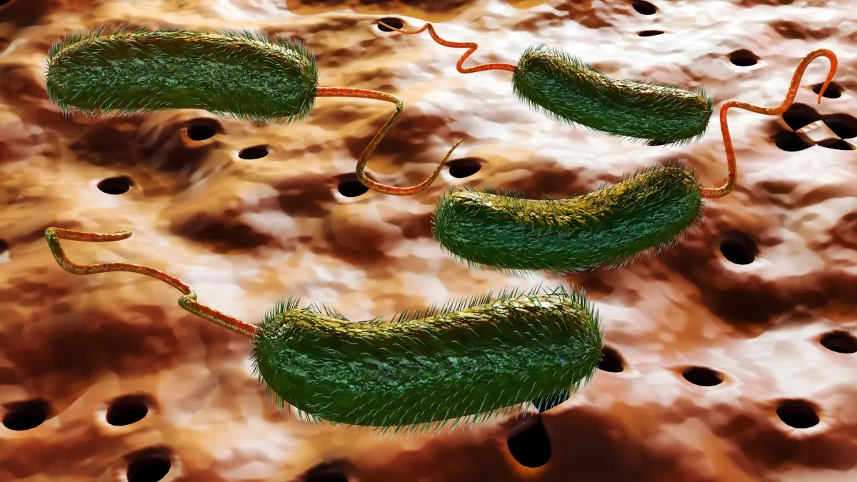 Perché il batterio che ha causato morti negli Stati Uniti è chiamato "mangia-carne"? Ecco cosa dovresti sapere sull'infezione e sui suoi sintomi allarmanti.