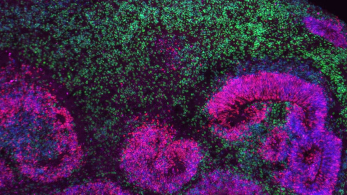 O maior mapa do cérebro em desenvolvimento revela as fases em que os distúrbios neurológicos se originam.