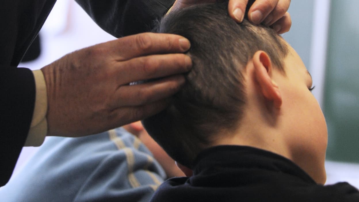The majority of anti-lice treatments sold in France deemed ineffective