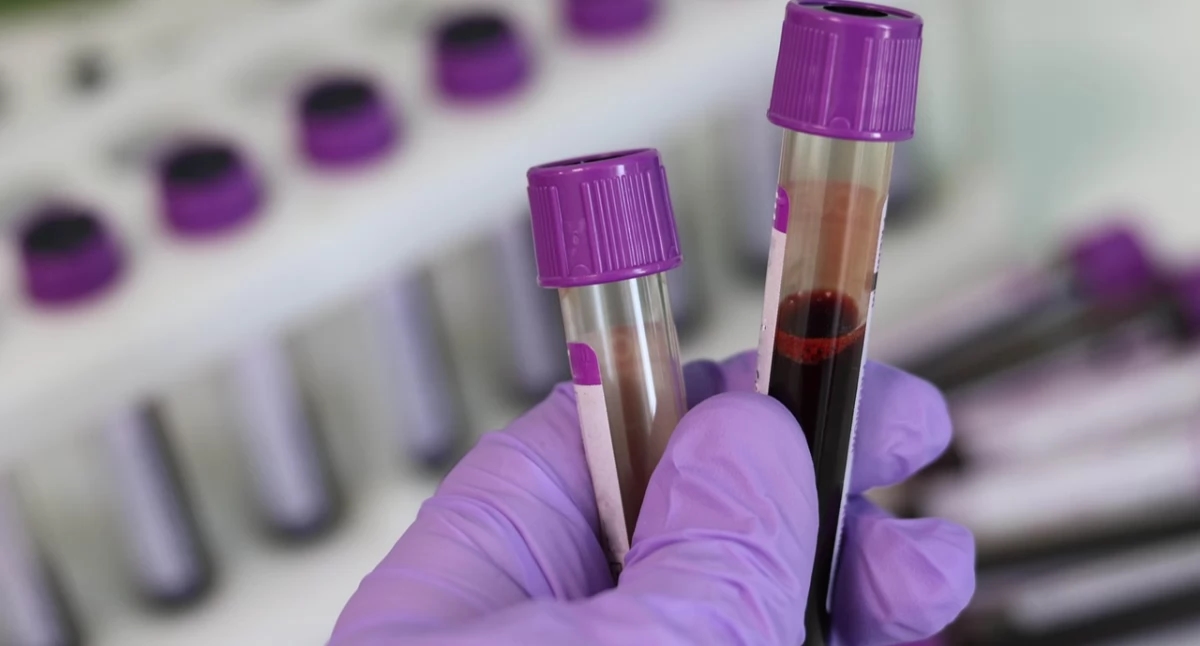 El Sejm dice "no" a los días libres flexibles para los donantes de sangre honorarios