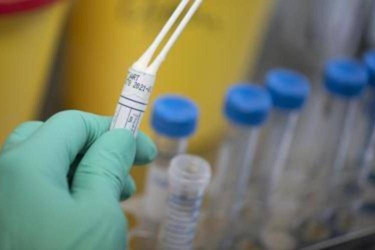 Legionella in Milan's public housing, one dead and several hospitalized