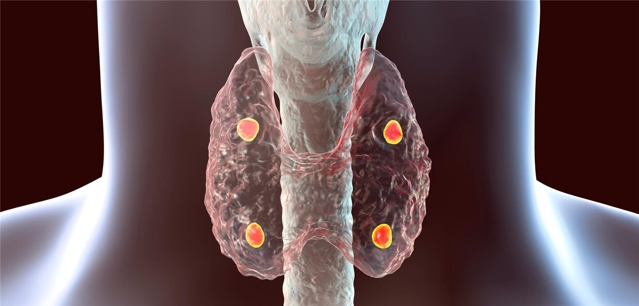 En cas d'hypoparathyroïdie, donner en priorité de la vitamine D active !