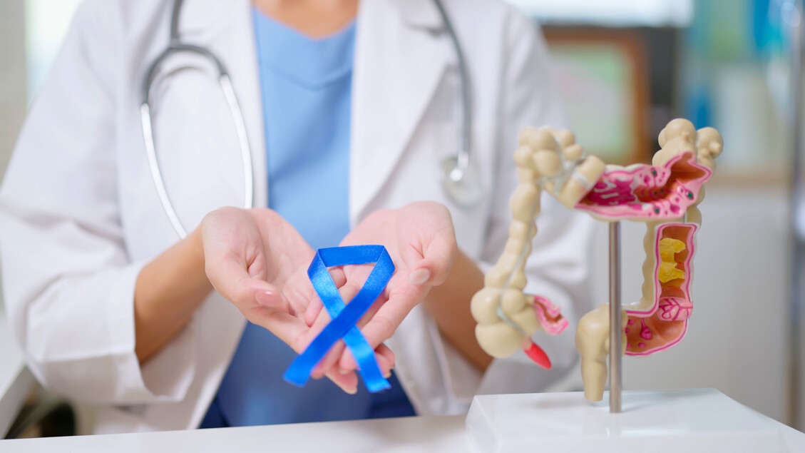 Neue Strategie macht Darmkrebs empfindlich für Immuntherapie