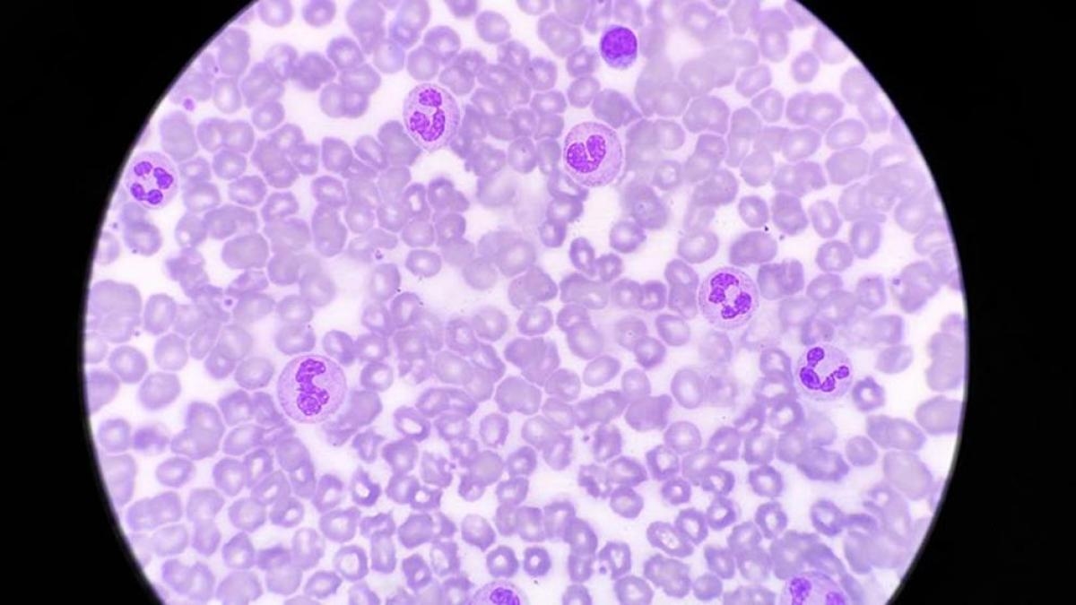 Daglicht kan het vermogen van het immuunsysteem om infecties te bestrijden versterken