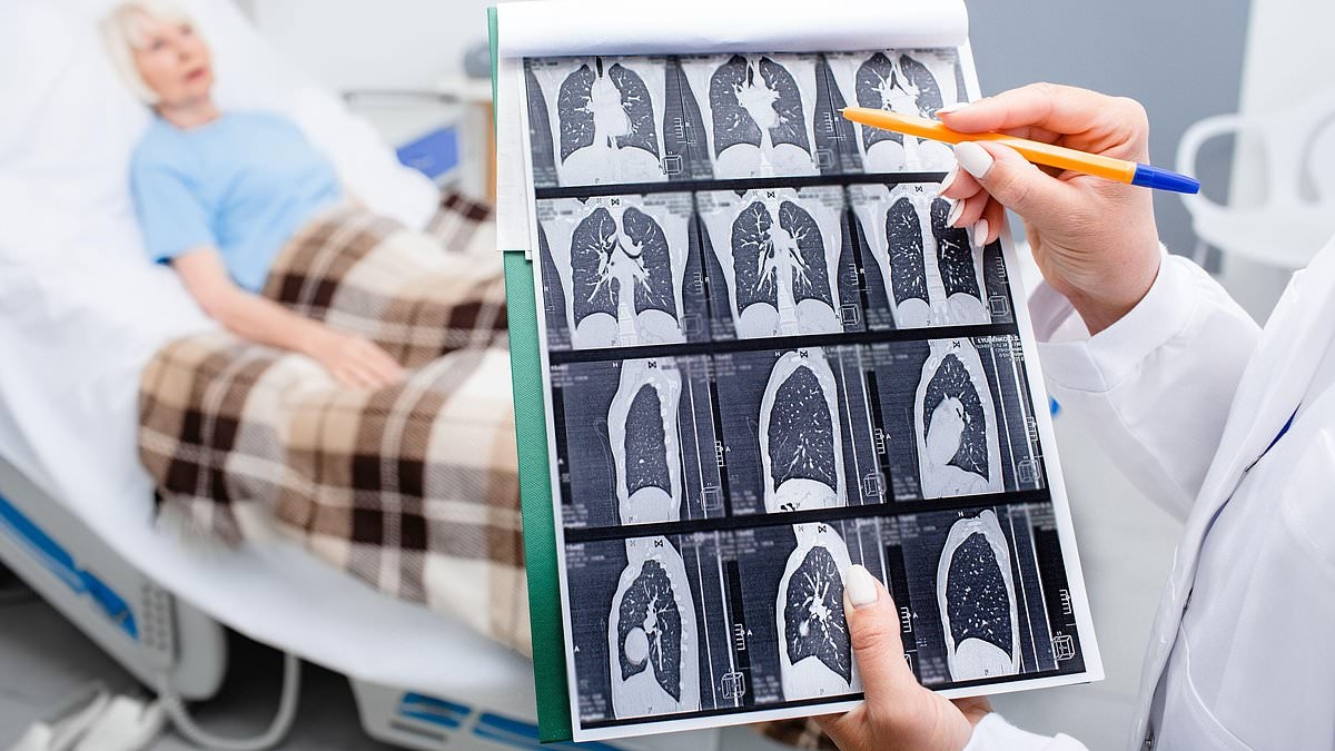 «Tenía un dolor insoportable... el médico dijo que solo eran molestias por la lactancia»: Gini, no fumadora, sufría un dolor agudo en el hombro. Finalmente, descubrió que se trataba de cáncer de pulmón. Ahora, nuestro experto revela los síntomas oculto...