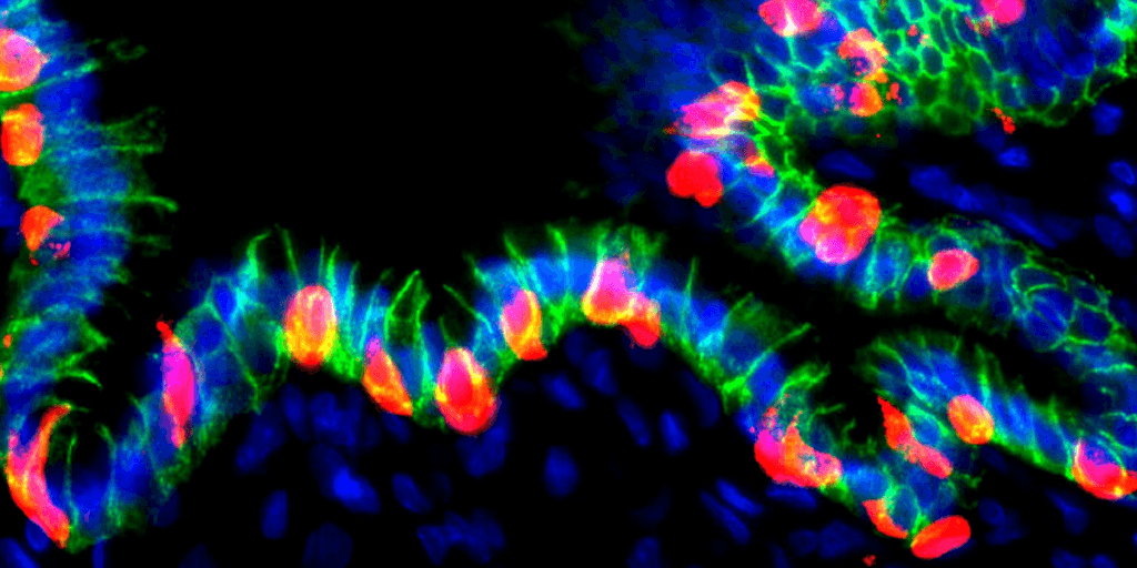 Przeprogramowane komórki żołądka produkują insulinę w celu leczenia cukrzycy