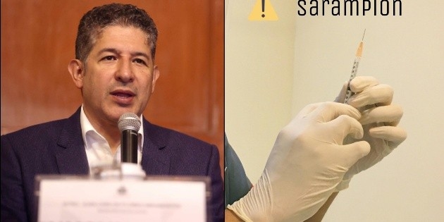Il Ministero dell'Istruzione chiede che i bambini affetti da morbillo non vengano mandati a scuola.